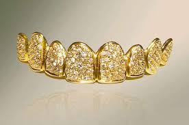 Grillz con Diamanti