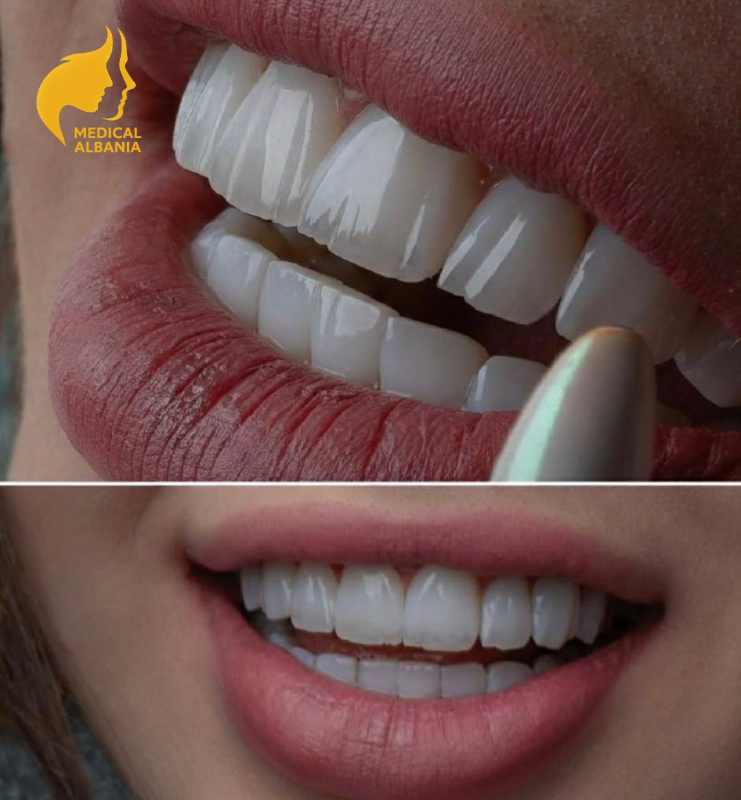 Prima e Dopo - Sorriso