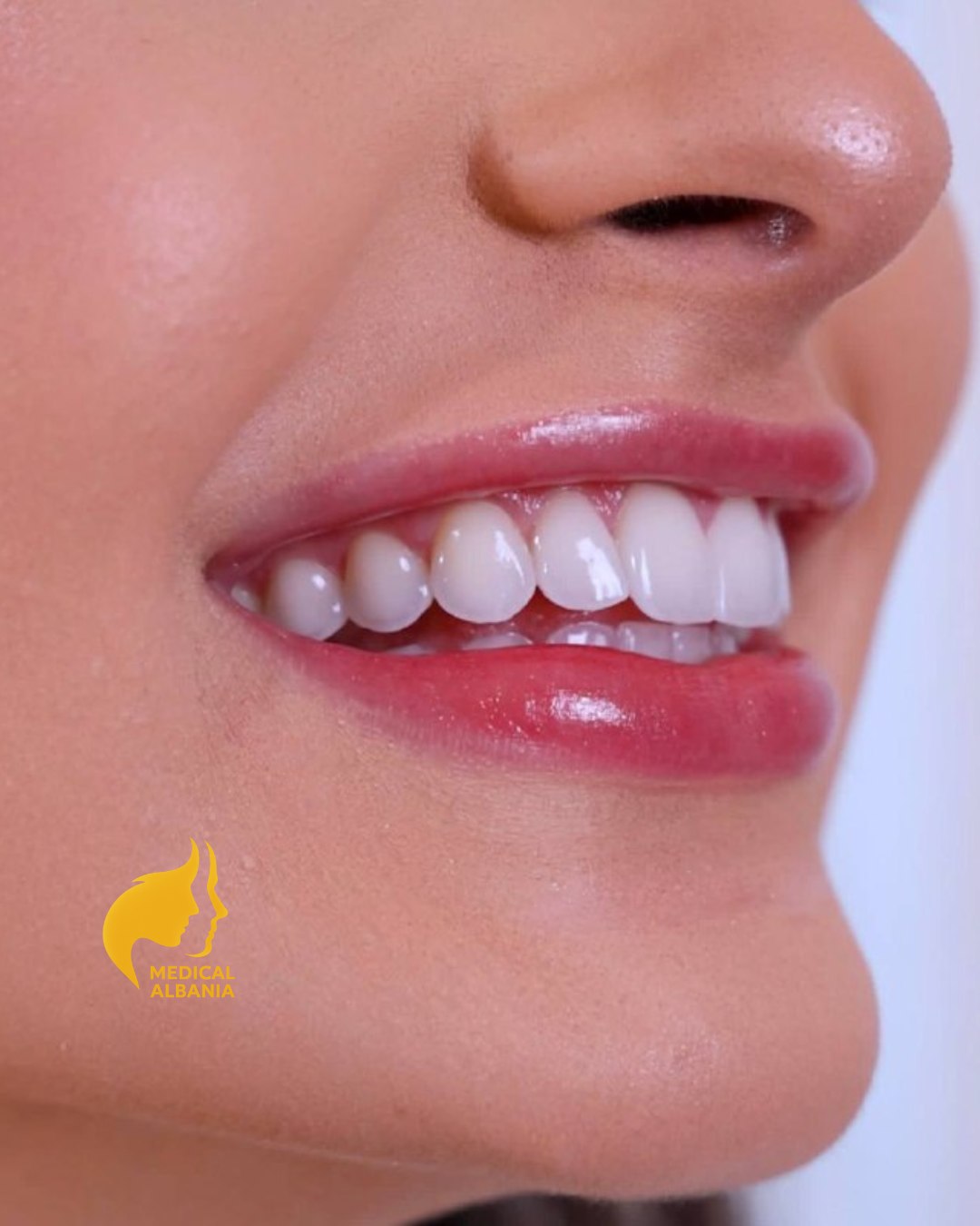 Prima e Dopo - Estetica